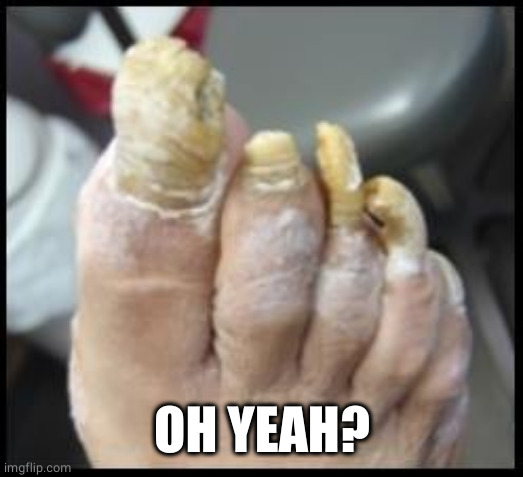 Ugly Toe Nails | OH YEAH? | image tagged in ugly toe nails | made w/ Imgflip meme maker