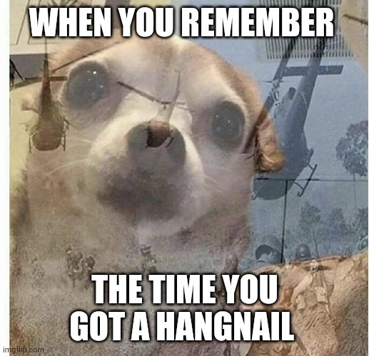 Hangnail trauma | WHEN YOU REMEMBER; THE TIME YOU GOT A HANGNAIL | image tagged in ptsd chihuahua | made w/ Imgflip meme maker