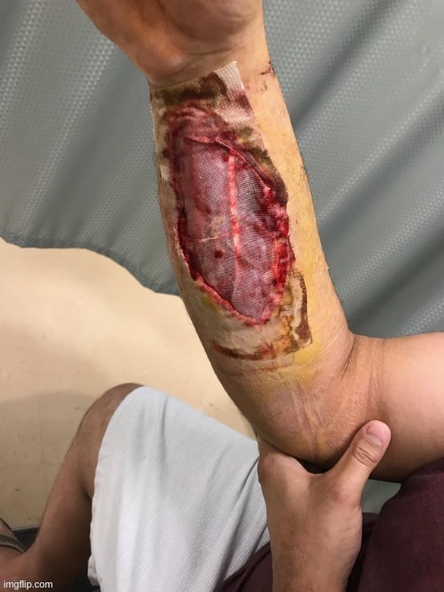 Someone’s arm | image tagged in someone s arm | made w/ Imgflip meme maker