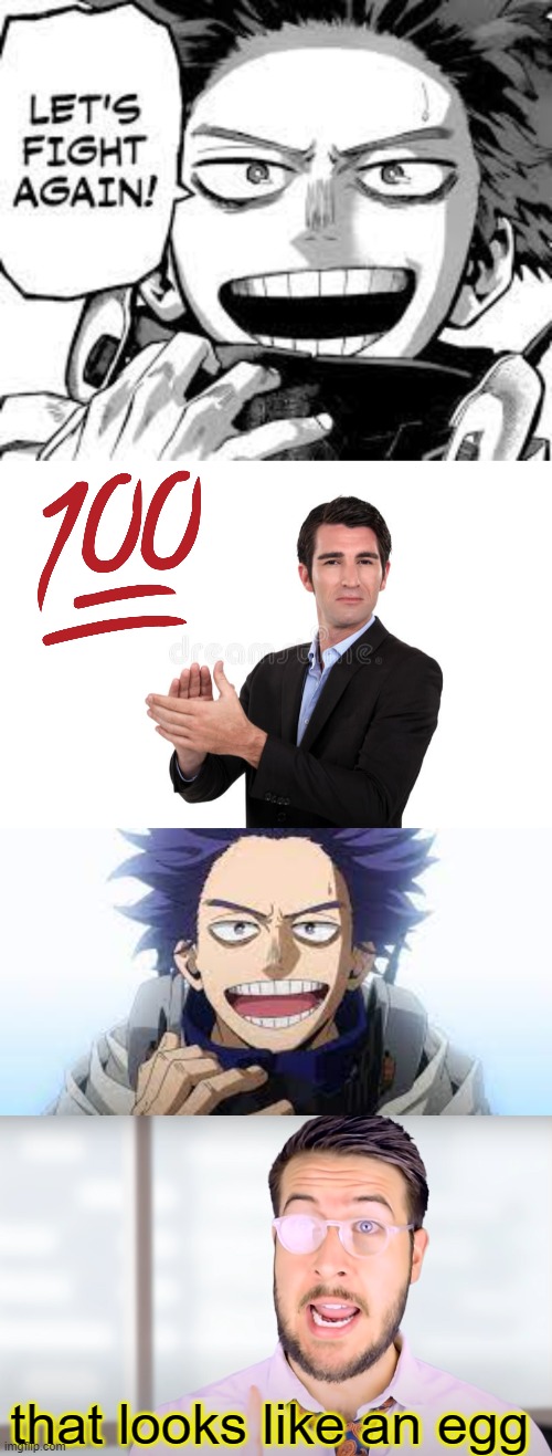 why did they make Shinso ugly in the anime ಥ_ಥ | that looks like an egg | image tagged in mha,my hero academia,hitoshi shinso,ryan george | made w/ Imgflip meme maker