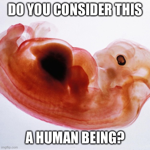 Do you? | DO YOU CONSIDER THIS; A HUMAN BEING? | image tagged in pro-choice | made w/ Imgflip meme maker