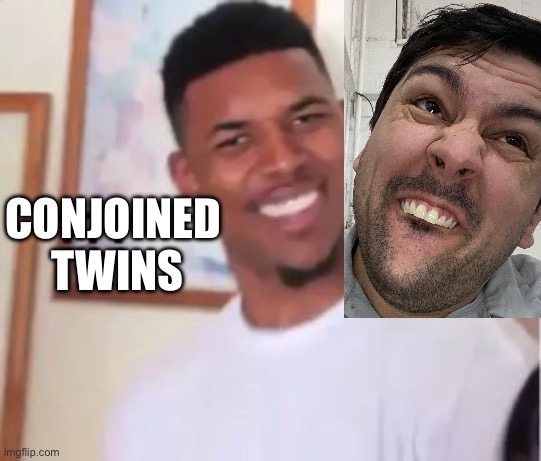 Conjoined twins | CONJOINED 
TWINS | image tagged in nick young | made w/ Imgflip meme maker