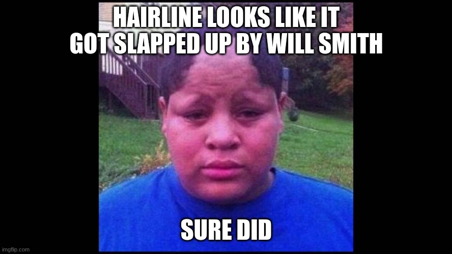 UGLY HAIRLINE  | HAIRLINE LOOKS LIKE IT GOT SLAPPED UP BY WILL SMITH; SURE DID | image tagged in ugly hairline,funny,will smith,slap | made w/ Imgflip meme maker