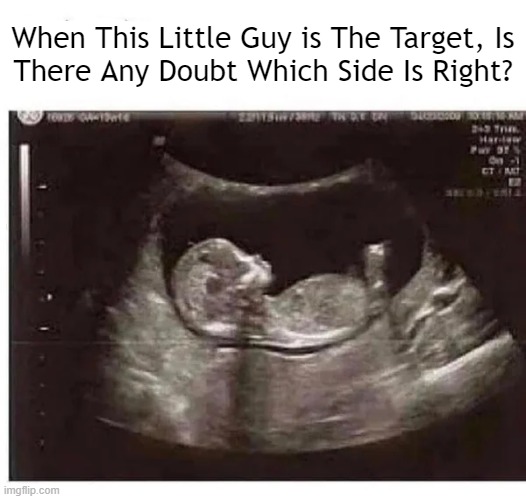 It's A Wonderful Life | When This Little Guy is The Target, Is
There Any Doubt Which Side Is Right? | image tagged in politics,liberals vs conservatives,it's a wonderful life,babies,gifts,wholesome content | made w/ Imgflip meme maker