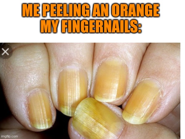 Why must they do this | ME PEELING AN ORANGE
MY FINGERNAILS: | image tagged in funny,orange,relatable | made w/ Imgflip meme maker