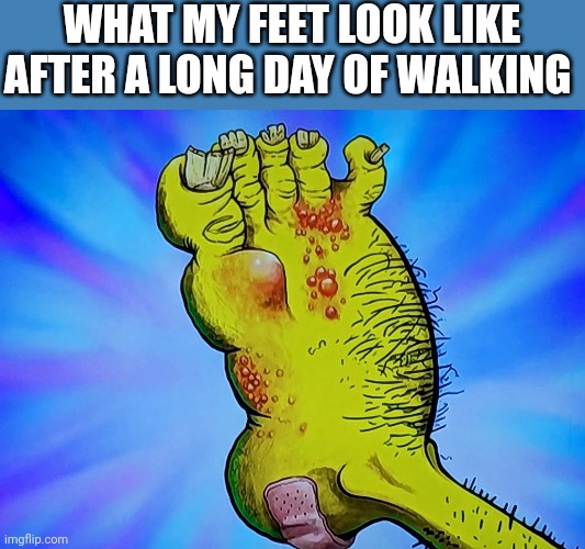 My feet hurt at the end of the day | WHAT MY FEET LOOK LIKE AFTER A LONG DAY OF WALKING | image tagged in memes | made w/ Imgflip meme maker