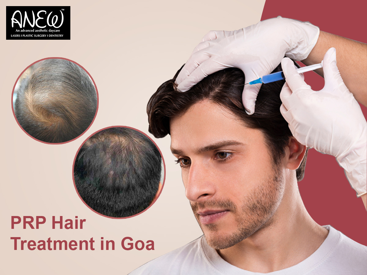 High Quality PRP Hair Treatment in Goa - Anew Blank Meme Template