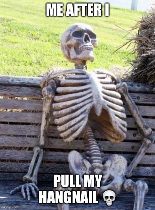 Waiting Skeleton | ME AFTER I; PULL MY HANGNAIL 💀 | image tagged in memes,waiting skeleton | made w/ Imgflip meme maker