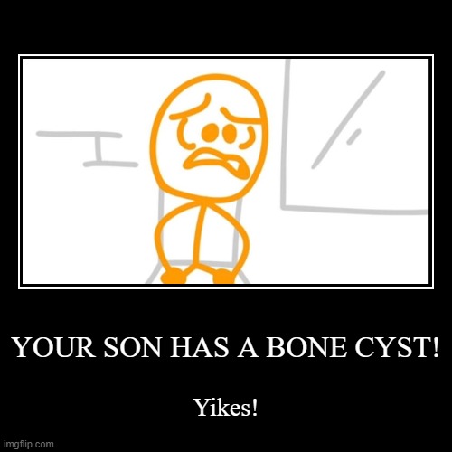 YOUR SON HAS BONE CYST (credit to toastednoodle) | image tagged in funny,demotivationals | made w/ Imgflip demotivational maker