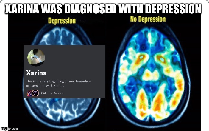 Xarina From Poitics Discord Server Was Diagnosed with depression | image tagged in depression,mental illness,sad,unhappy,politics,political meme | made w/ Imgflip meme maker