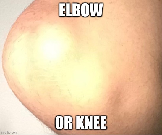 yes this is me btw | ELBOW; OR KNEE | made w/ Imgflip meme maker
