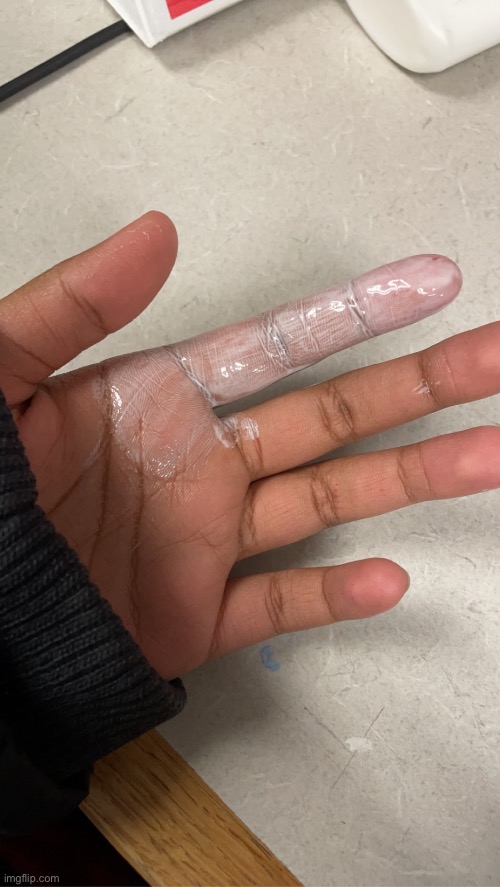 It’s glue just saying | made w/ Imgflip meme maker