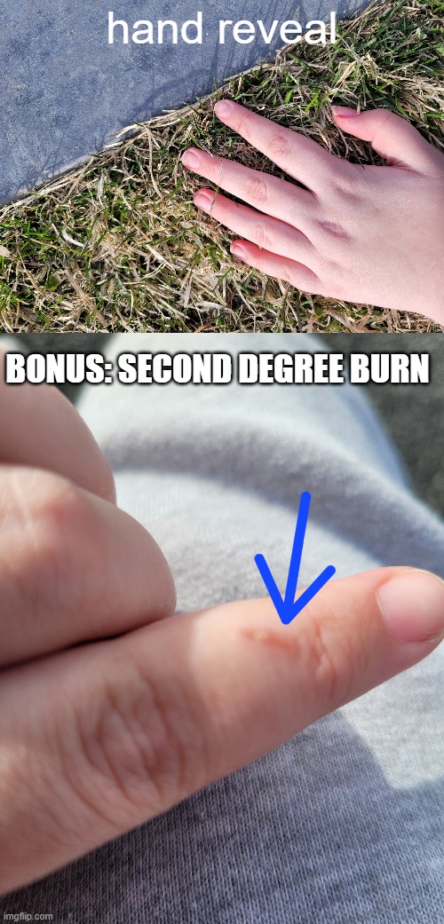 fennek hand reveal (real) | hand reveal; BONUS: SECOND DEGREE BURN | made w/ Imgflip meme maker