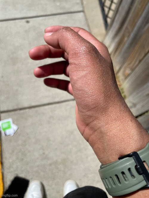 Random veins like I deathlift or sm | made w/ Imgflip meme maker
