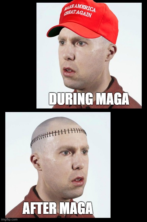 before during after... | DURING MAGA; AFTER MAGA | image tagged in magat,brain,maga,trump supporters,brainwashed,basket of deplorables | made w/ Imgflip meme maker