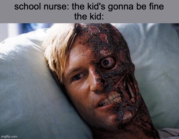 he's fine | school nurse: the kid's gonna be fine
the kid: | image tagged in two face | made w/ Imgflip meme maker