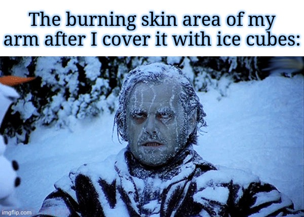 Arm | The burning skin area of my arm after I cover it with ice cubes: | image tagged in freezing cold,funny,memes,blank white template,i am healthcare,ice | made w/ Imgflip meme maker