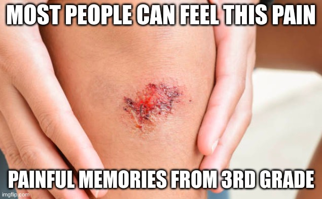 painful memories from 3rd grade | MOST PEOPLE CAN FEEL THIS PAIN; PAINFUL MEMORIES FROM 3RD GRADE | image tagged in oof,hurt | made w/ Imgflip meme maker