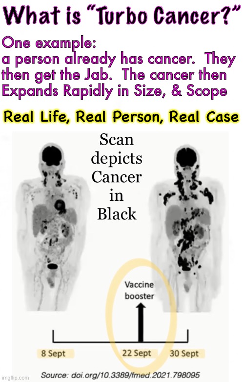 Wow… that’s fast!   It’s TURBO BOOST | What is “Turbo Cancer?”; One example:
a person already has cancer.  They
then get the Jab.  The cancer then
Expands Rapidly in Size, & Scope; Real Life, Real Person, Real Case | image tagged in memes,jab,vax,vaccine,tough way to go,get right with god | made w/ Imgflip meme maker