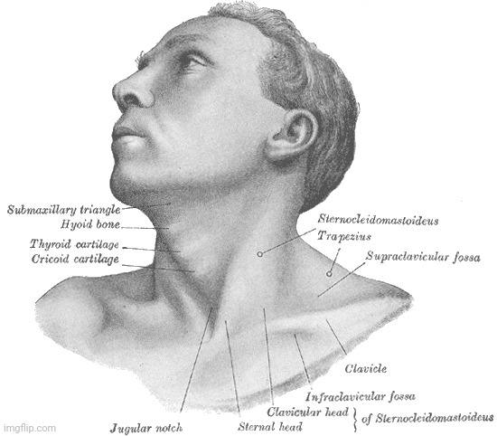 Kid named Torticollis: | made w/ Imgflip meme maker