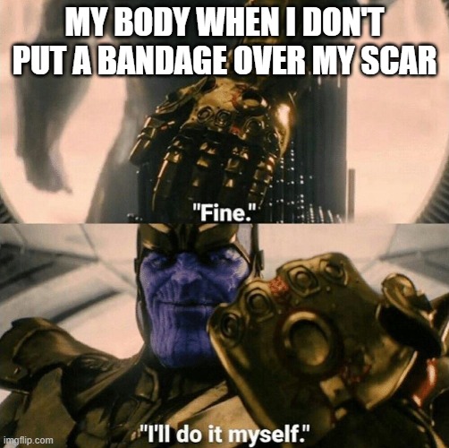 like you know when you get a scar and you dont put a bandage over it and then theres some yellow thing over it? | MY BODY WHEN I DON'T PUT A BANDAGE OVER MY SCAR | image tagged in fine i'll do it myself,the human body | made w/ Imgflip meme maker