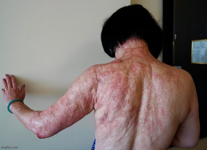 Napalm Girl Vietnam 50 years later | image tagged in napalm girl vietnam 50 years later | made w/ Imgflip meme maker