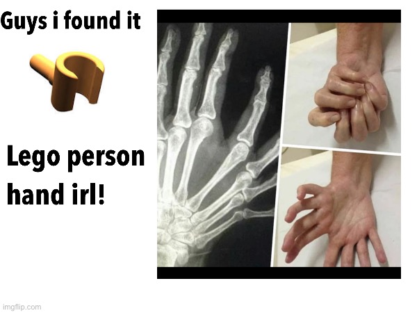 It's called "mirror hand syndrome" btw | image tagged in lego,haha,haha funny | made w/ Imgflip meme maker