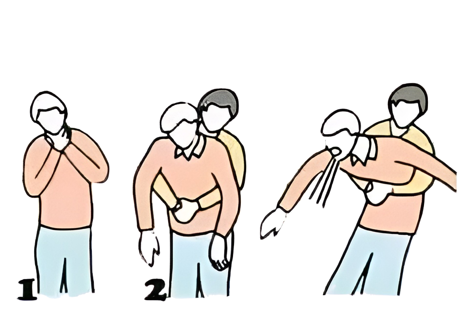 High Quality Emergency procedure for when someone is choking Blank Meme Template