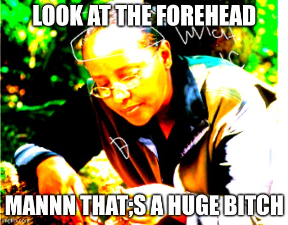 fore haed | LOOK AT THE FOREHEAD; MANNN THAT;S A HUGE BITCH | image tagged in funny memes | made w/ Imgflip meme maker