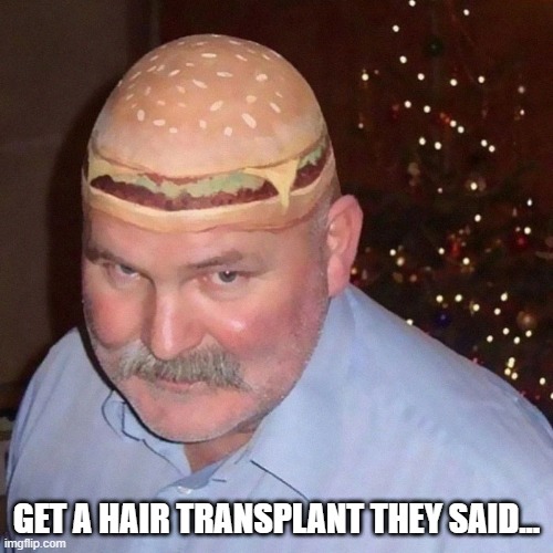 Ooh New Hair | GET A HAIR TRANSPLANT THEY SAID... | image tagged in unsee juice | made w/ Imgflip meme maker