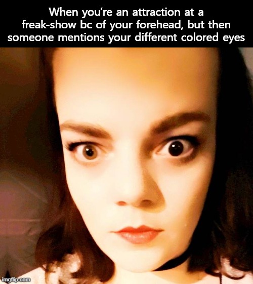 I turn ppl into memes, why not | When you're an attraction at a freak-show bc of your forehead, but then someone mentions your different colored eyes | image tagged in funny | made w/ Imgflip meme maker