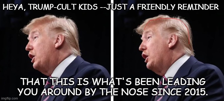 Garrilus Stultus, shining beacon of Durr and the USA's first known mentally disabled President. | HEYA, TRUMP-CULT KIDS --JUST A FRIENDLY REMINDER; THAT THIS IS WHAT'S BEEN LEADING YOU AROUND BY THE NOSE SINCE 2015. | image tagged in microcephaly,derp,trump unfit unqualified dangerous | made w/ Imgflip meme maker