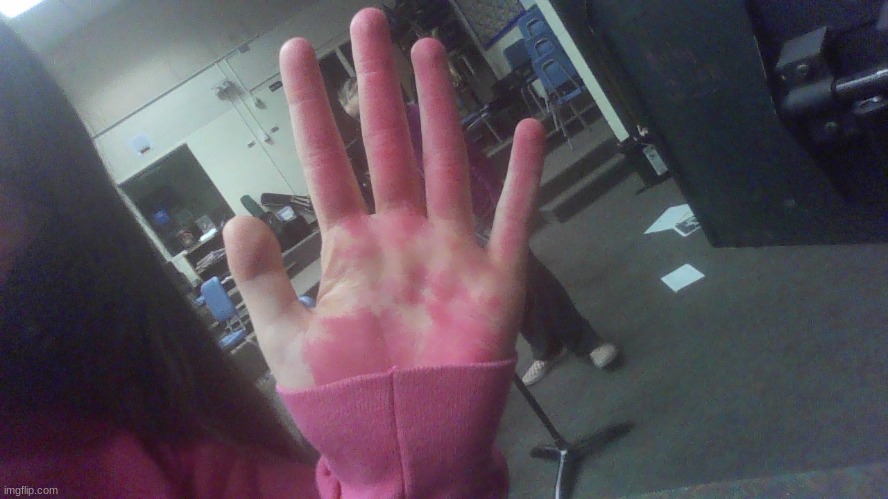 I was playing with dye yesterday and now my hand is as pink as my sweatshirt lol | image tagged in pink dye | made w/ Imgflip meme maker
