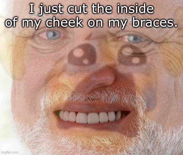 Ouch. | I just cut the inside of my cheek on my braces. | image tagged in hide the pain harold with crying emoji | made w/ Imgflip meme maker