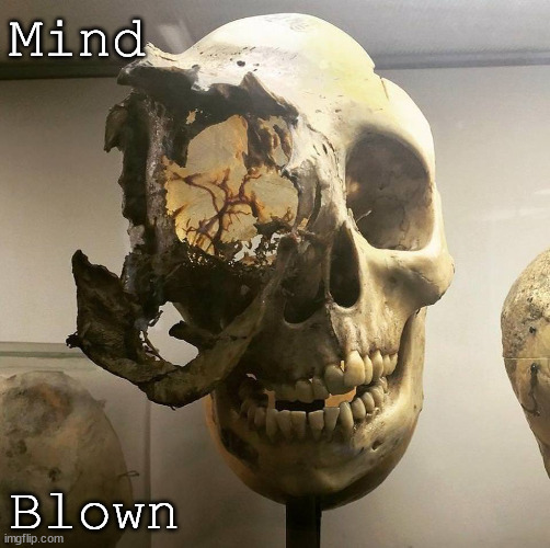 Self explanatory - you did something that felt like a little explosion in my brain | Mind; Blown | image tagged in blow my mind,fun,anatomy,skull,spooky,cancer | made w/ Imgflip meme maker