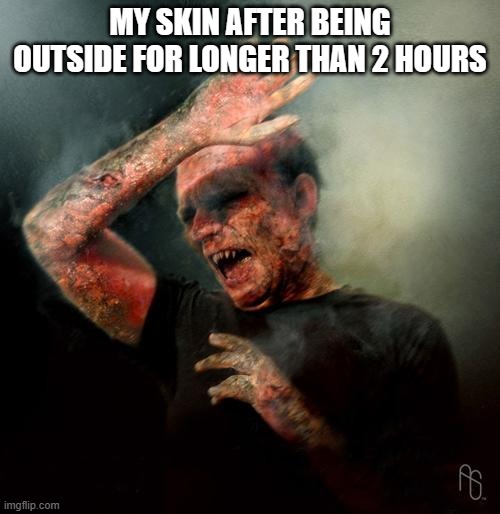 burning vampire | MY SKIN AFTER BEING OUTSIDE FOR LONGER THAN 2 HOURS | image tagged in burning vampire | made w/ Imgflip meme maker