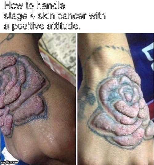 stay positive | How to handle stage 4 skin cancer with a positive attitude. | image tagged in memes,dark humor | made w/ Imgflip meme maker