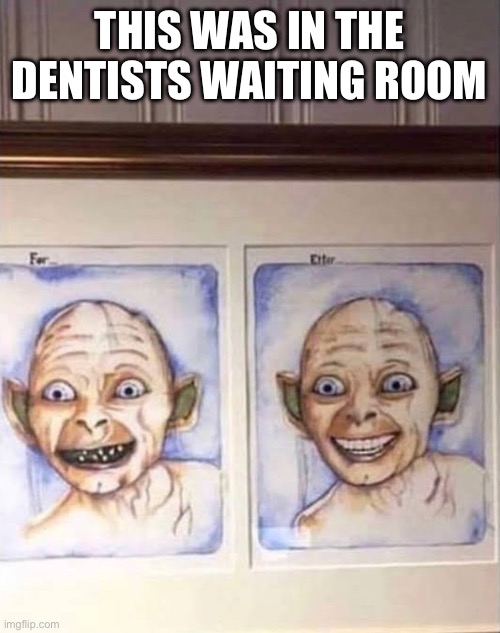 This was in the dentist’s waiting room | THIS WAS IN THE DENTISTS WAITING ROOM | image tagged in dentist,dentists,golem,funny memes,funny,fun | made w/ Imgflip meme maker