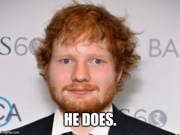 Derpy Ed Sheeran | HE DOES. | image tagged in derpy ed sheeran | made w/ Imgflip meme maker