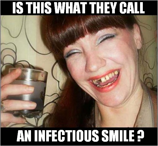 Get Thee To A Dentist ! | IS THIS WHAT THEY CALL; AN INFECTIOUS SMILE ? | image tagged in dentist,rotten,teeth,infection,smile,dark humour | made w/ Imgflip meme maker