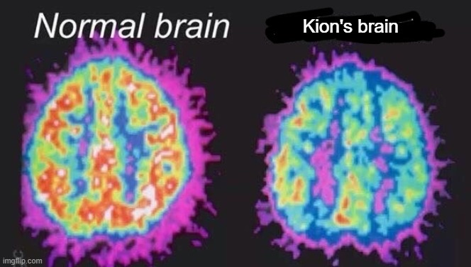 Normal brain vs mentally ill brain | Kion's brain | image tagged in normal brain vs mentally ill brain | made w/ Imgflip meme maker