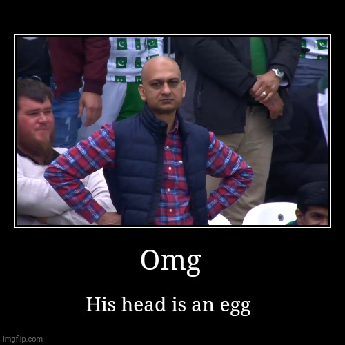Omg | His head is an egg | image tagged in funny,demotivationals | made w/ Imgflip demotivational maker
