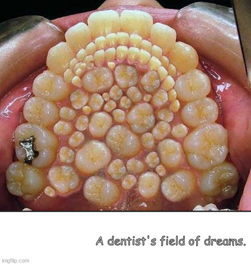 Enameled wonderland | A dentist's field of dreams. | image tagged in memes,cursed | made w/ Imgflip meme maker