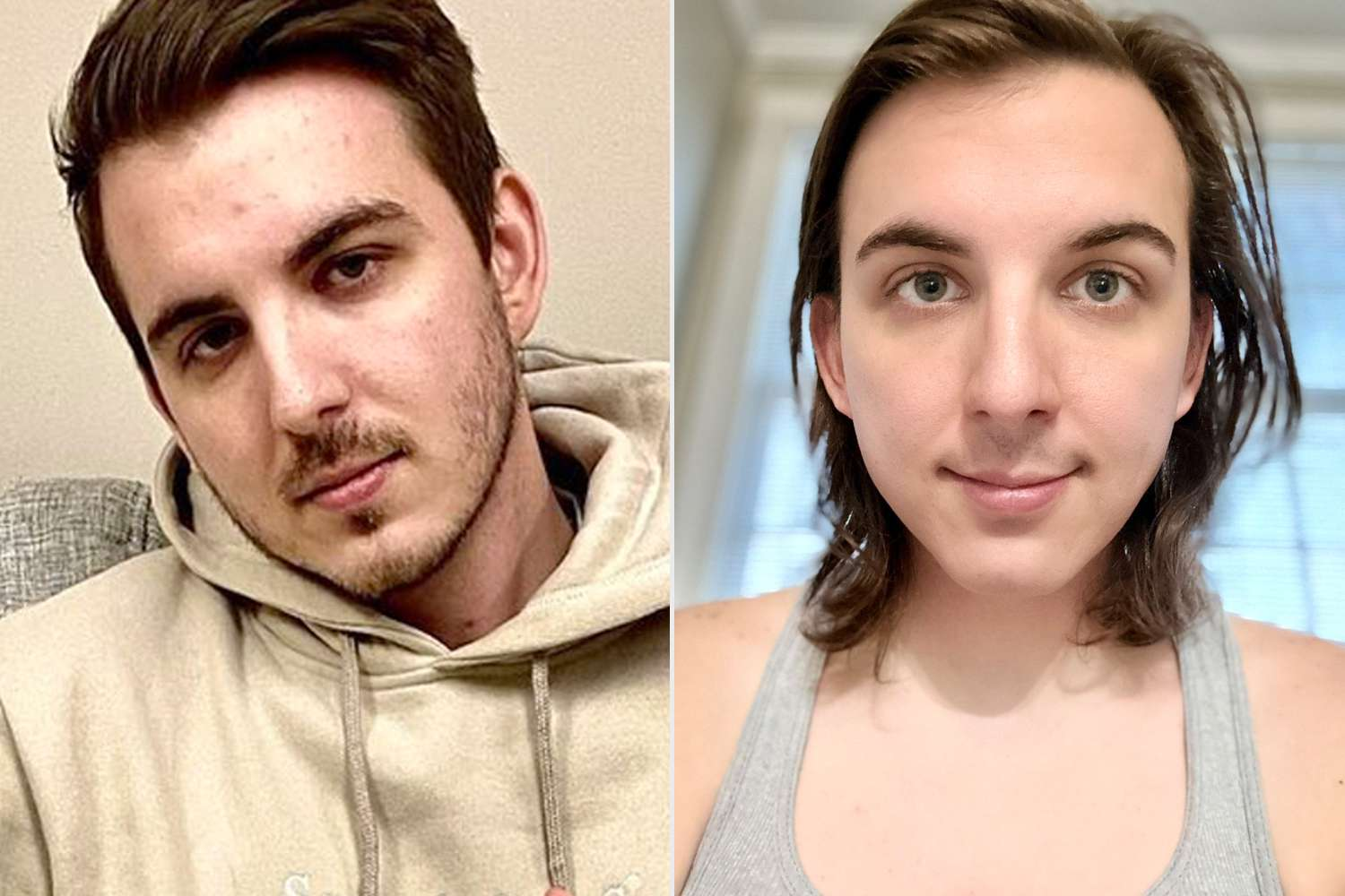 High Quality MrBeast YouTube Star Chris Tyson Started Hormone Replacement The Blank Meme Template