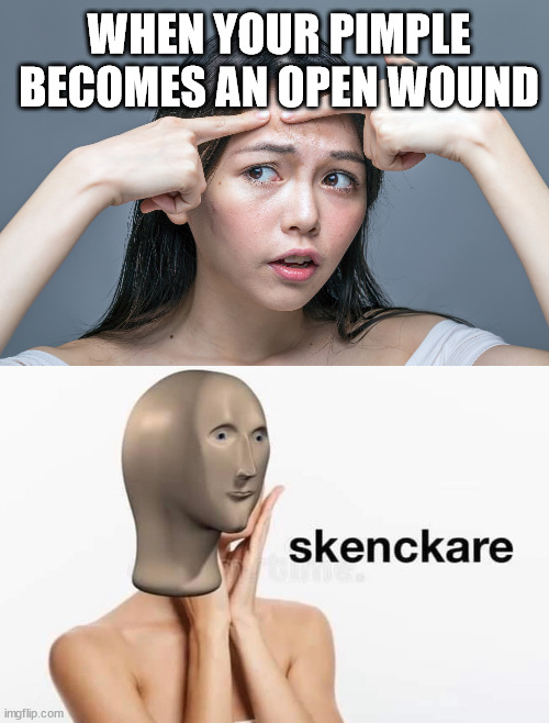 WHEN YOUR PIMPLE BECOMES AN OPEN WOUND | image tagged in pimple zit acne | made w/ Imgflip meme maker