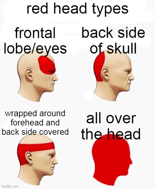 red heads | red head types; back side of skull; frontal lobe/eyes; all over the head; wrapped around forehead and back side covered | image tagged in red | made w/ Imgflip meme maker