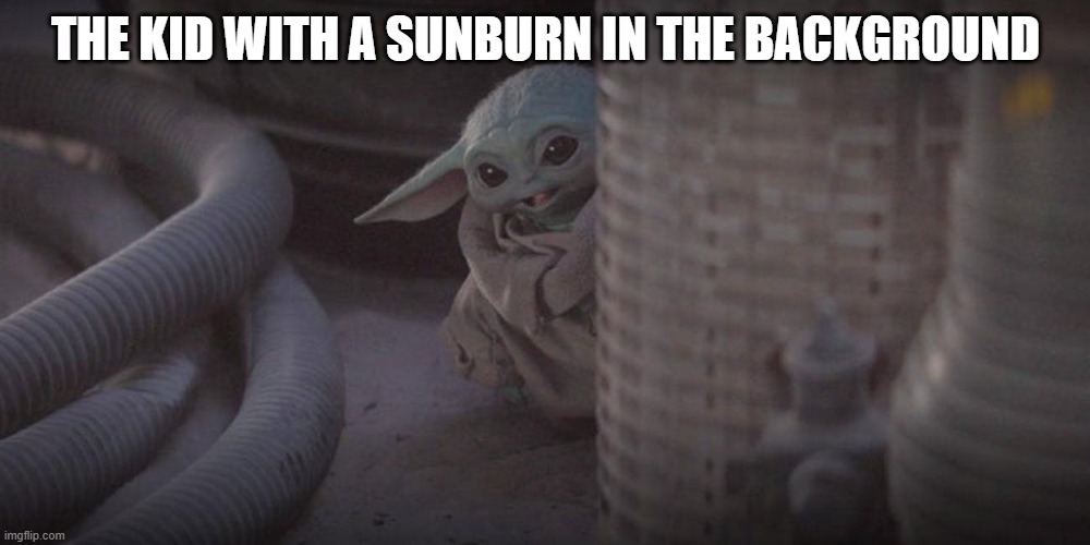 Baby Yoda Peek | THE KID WITH A SUNBURN IN THE BACKGROUND | image tagged in baby yoda peek | made w/ Imgflip meme maker