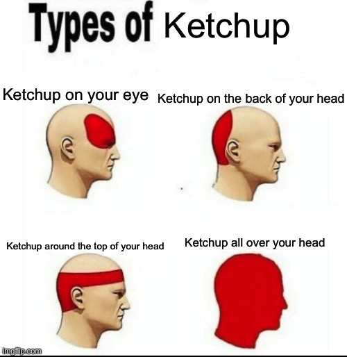 This is coming from a ketchup expert | Ketchup; Ketchup on your eye; Ketchup on the back of your head; Ketchup around the top of your head; Ketchup all over your head | image tagged in types of headaches meme | made w/ Imgflip meme maker