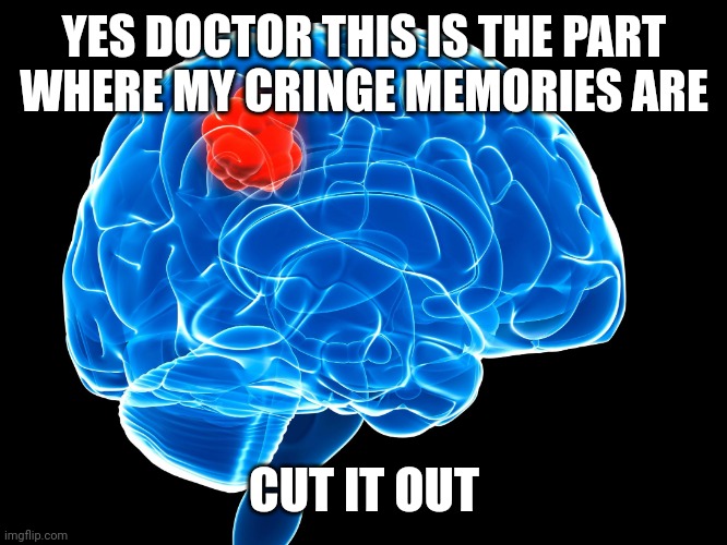 brain tumor | YES DOCTOR THIS IS THE PART WHERE MY CRINGE MEMORIES ARE CUT IT OUT | image tagged in brain tumor | made w/ Imgflip meme maker