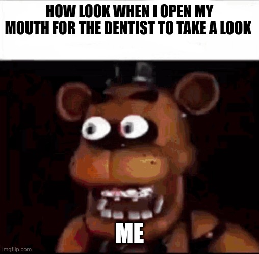 The dentist will forever be traumatized by the time I opened my mouth | HOW LOOK WHEN I OPEN MY MOUTH FOR THE DENTIST TO TAKE A LOOK; ME | image tagged in shocked freddy fazbear | made w/ Imgflip meme maker